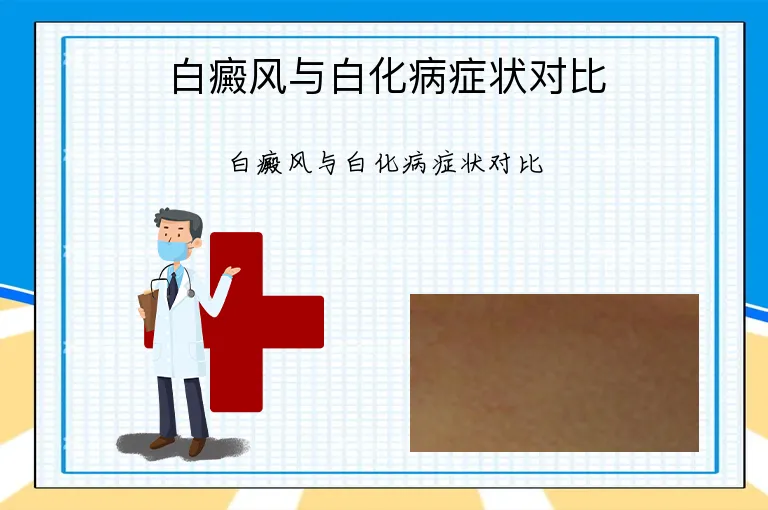 白癜风与白化病症状对比