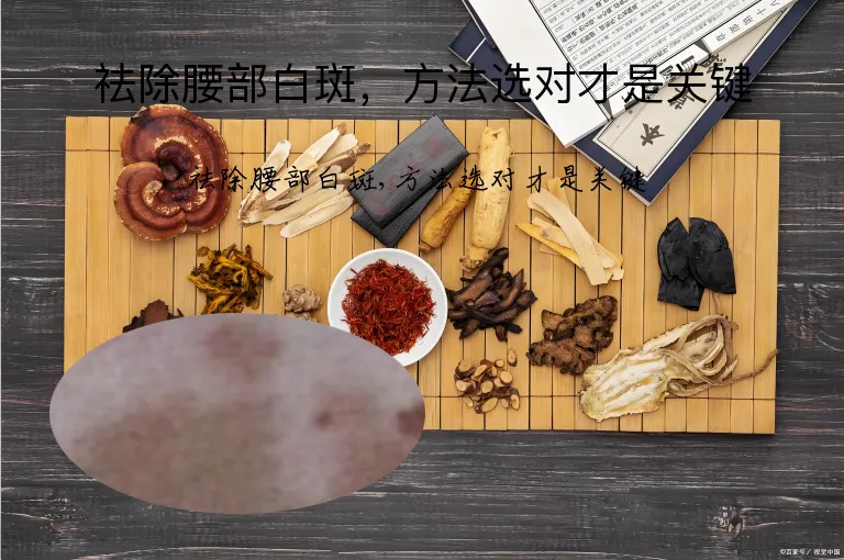 祛除腰部白斑，方法选对才是关键