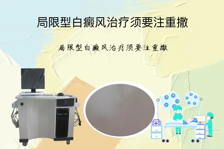 局限型白癜风治疗须要注重撒