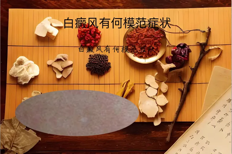 白癜风有何模范症状
