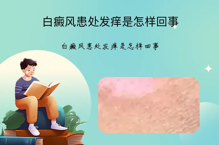 白癜风患处发痒是怎样回事