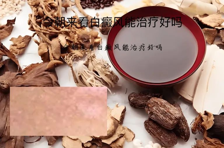 今朝来看白癜风能治疗好吗