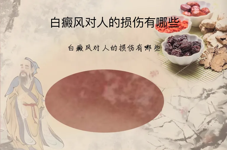 白癜风对人的损伤有哪些