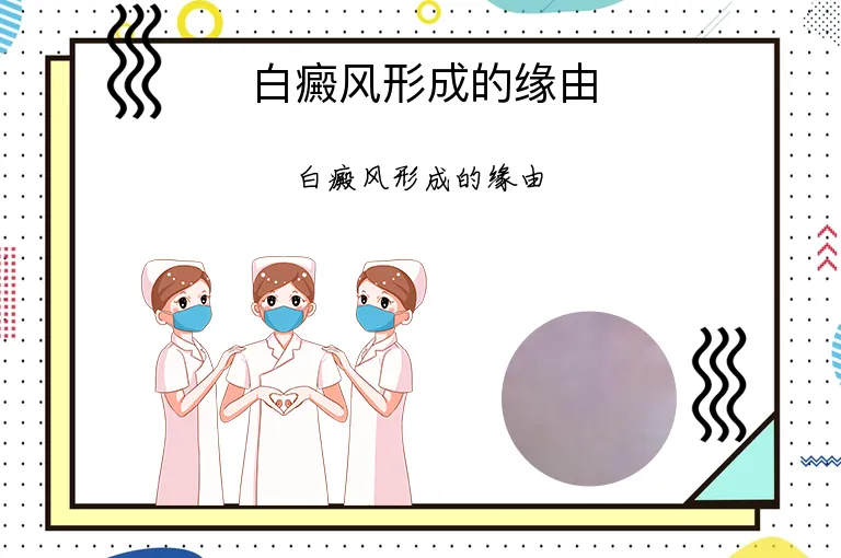白癜风形成的缘由