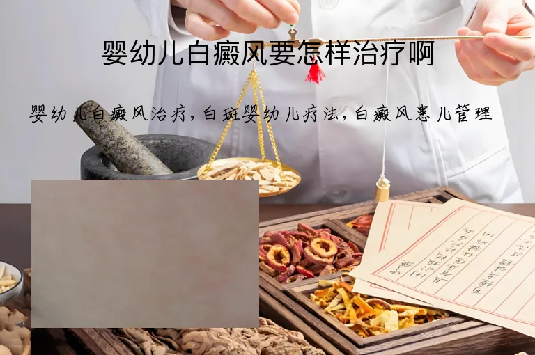 婴幼儿白癜风要怎样治疗啊
