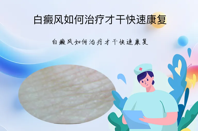 白癜风如何治疗才干快速康复