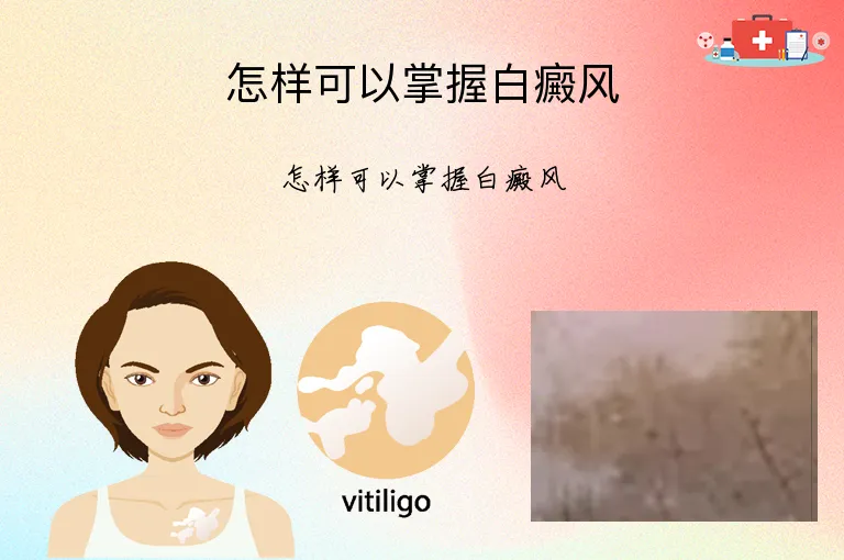 怎样可以掌握白癜风