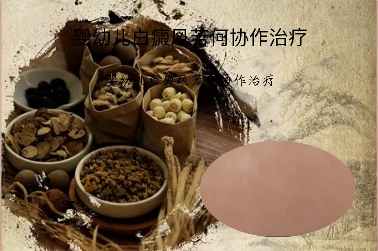 婴幼儿白癜风若何协作治疗