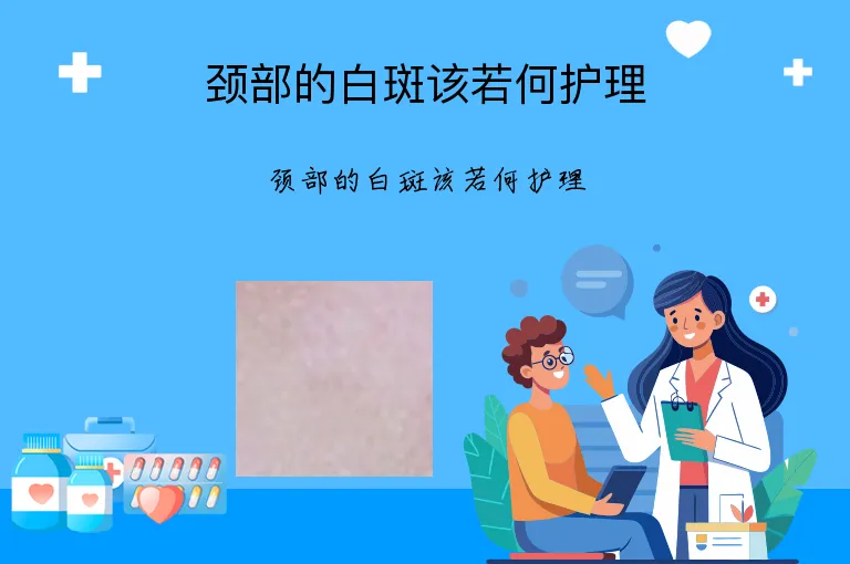 颈部的白斑该若何护理