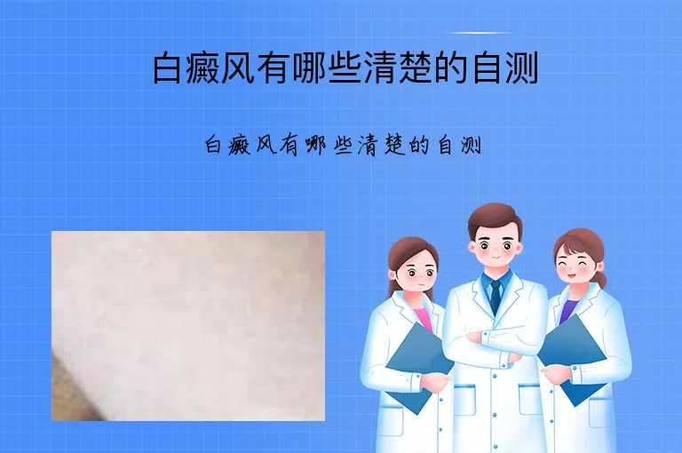 白癜风有哪些清楚的自测