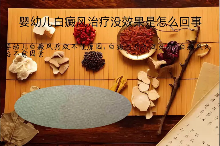 婴幼儿白癜风治疗没效果是怎么回事