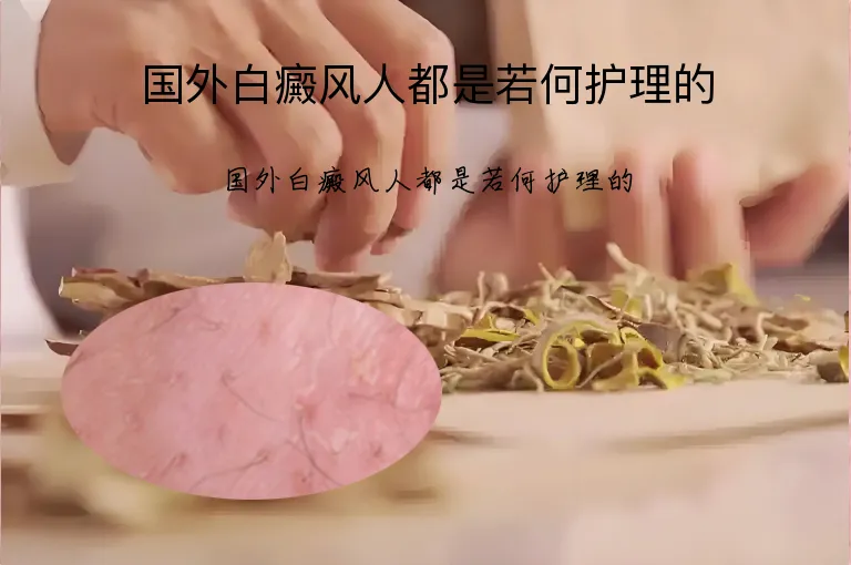 国外白癜风人都是若何护理的