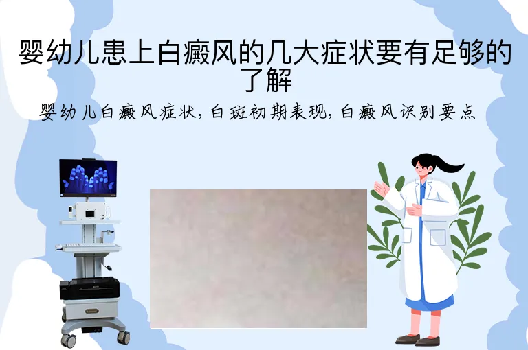 婴幼儿患上白癜风的几大症状要有足够的了解