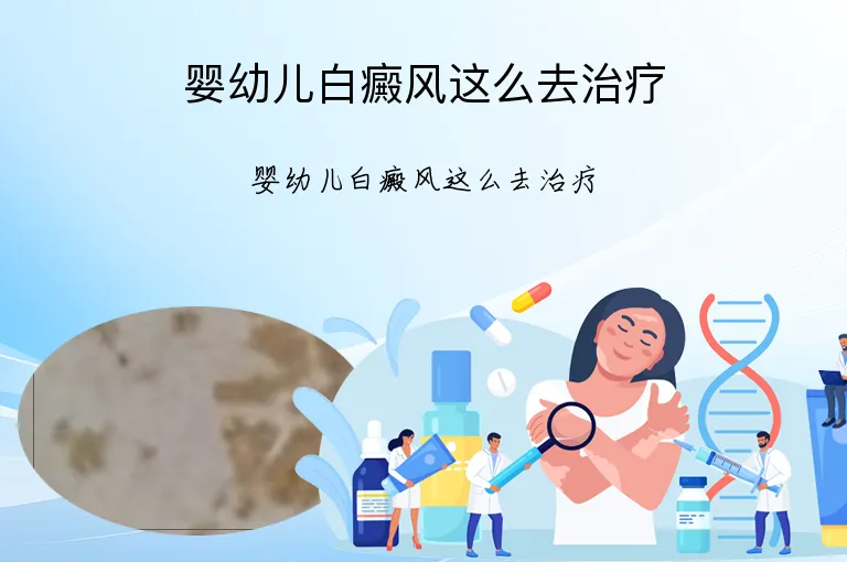 婴幼儿白癜风这么去治疗