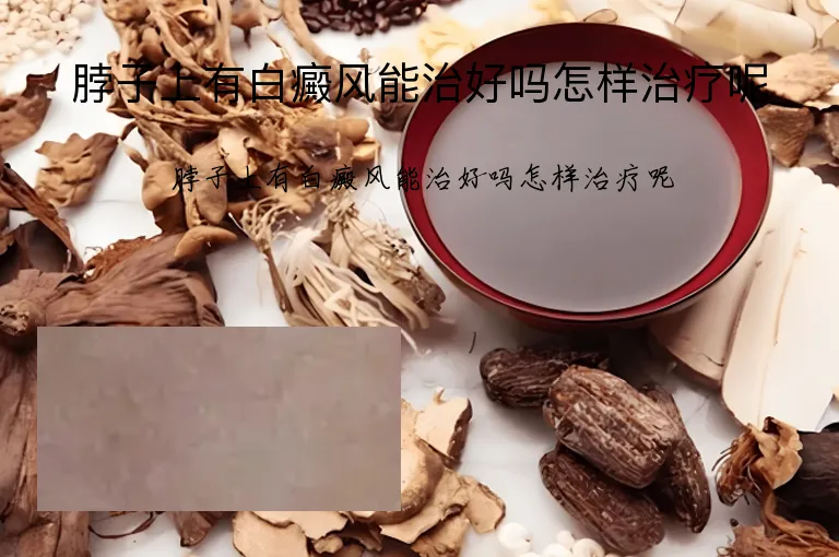 脖子上有白癜风能治好吗怎样治疗呢