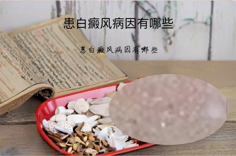 患白癜风病因有哪些