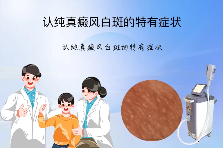 认纯真癜风白斑的特有症状