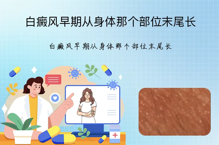 白癜风早期从身体那个部位末尾长