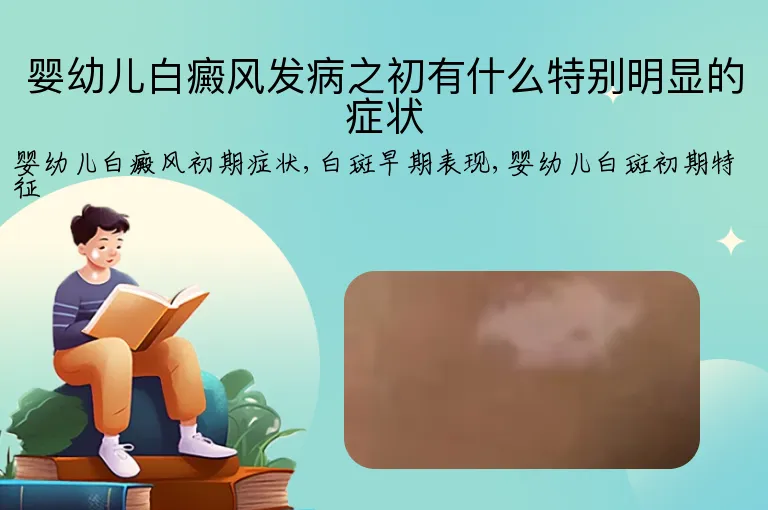 婴幼儿白癜风发病之初有什么特别明显的症状