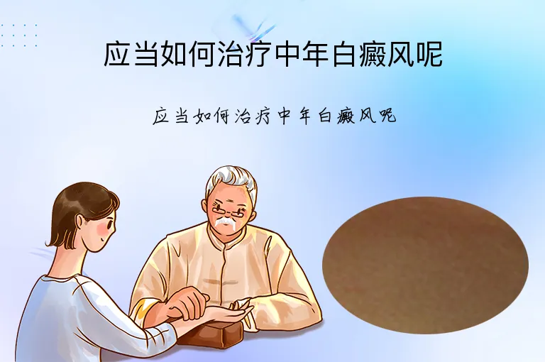 应当如何治疗中年白癜风呢