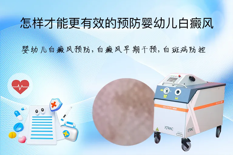 怎样才能更有效的预防婴幼儿白癜风