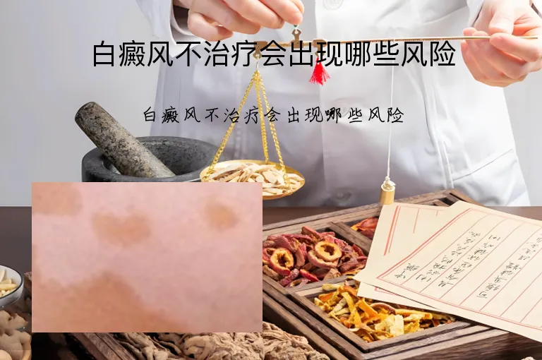白癜风不治疗会出现哪些风险