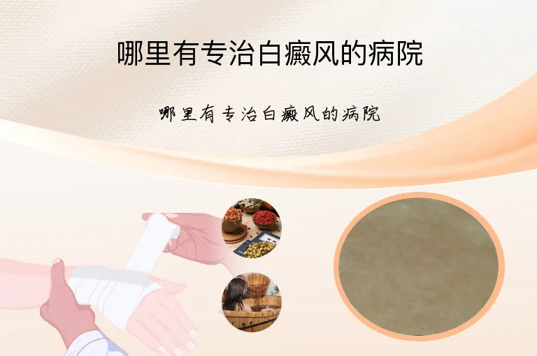 哪里有专治白癜风的病院