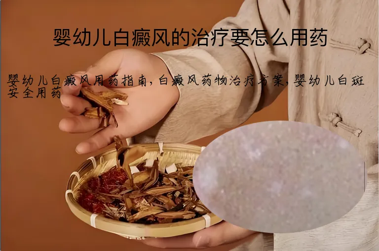 婴幼儿白癜风的治疗要怎么用药