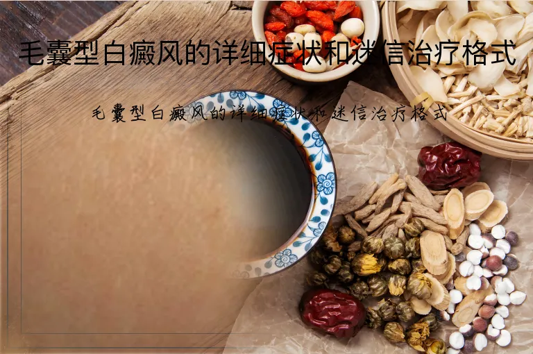 毛囊型白癜风的详细症状和迷信治疗格式