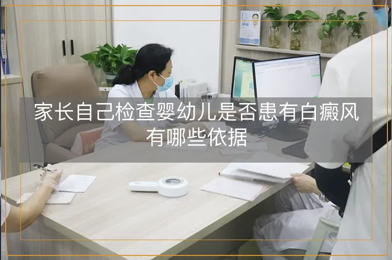 家长自己检查婴幼儿是否患有白癜风有哪些依据