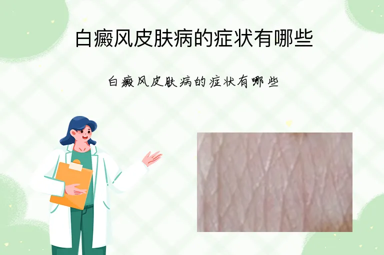 白癜风皮肤病的症状有哪些