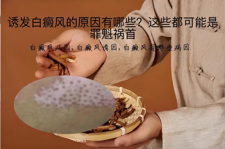 诱发白癜风的原因有哪些？这些都可能是罪魁祸首
