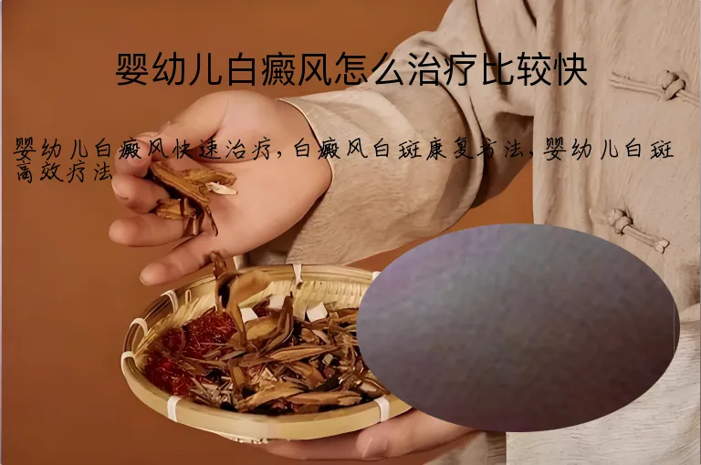 婴幼儿白癜风怎么治疗比较快