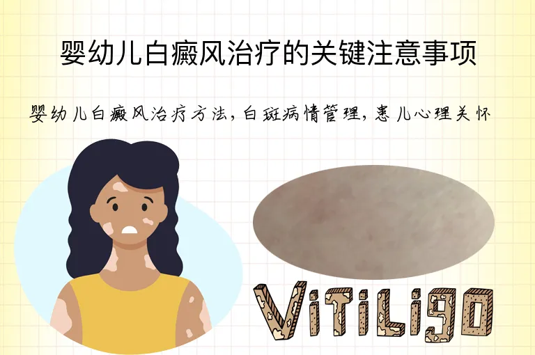 婴幼儿白癜风治疗的关键注意事项