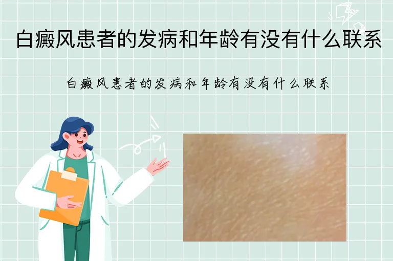 白癜风患者的发病和年龄有没有什么联系