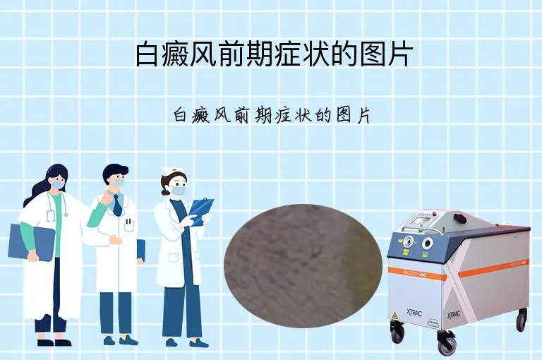 白癜风前期症状的图片