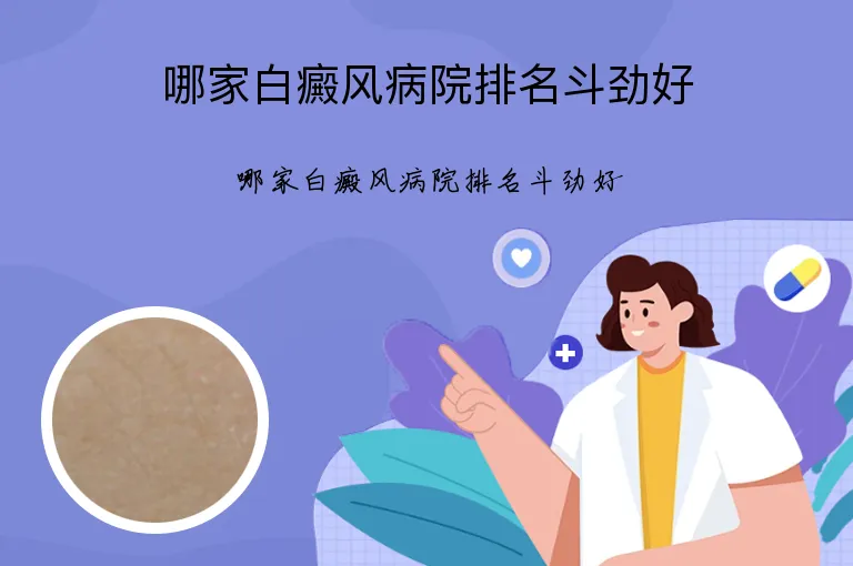 哪家白癜风病院排名斗劲好