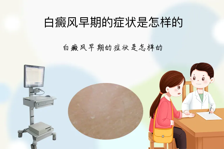 白癜风早期的症状是怎样的