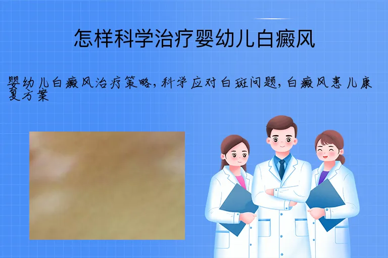怎样科学治疗婴幼儿白癜风