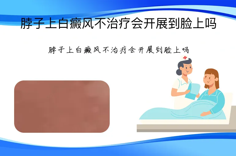脖子上白癜风不治疗会开展到脸上吗