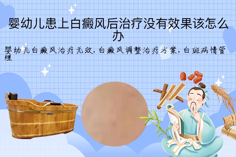 婴幼儿患上白癜风后治疗没有效果该怎么办