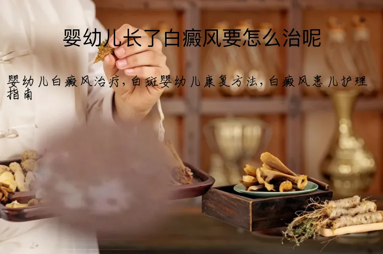 婴幼儿长了白癜风要怎么治呢