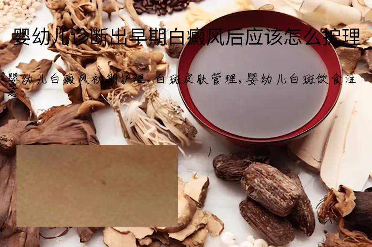 婴幼儿诊断出早期白癜风后应该怎么护理