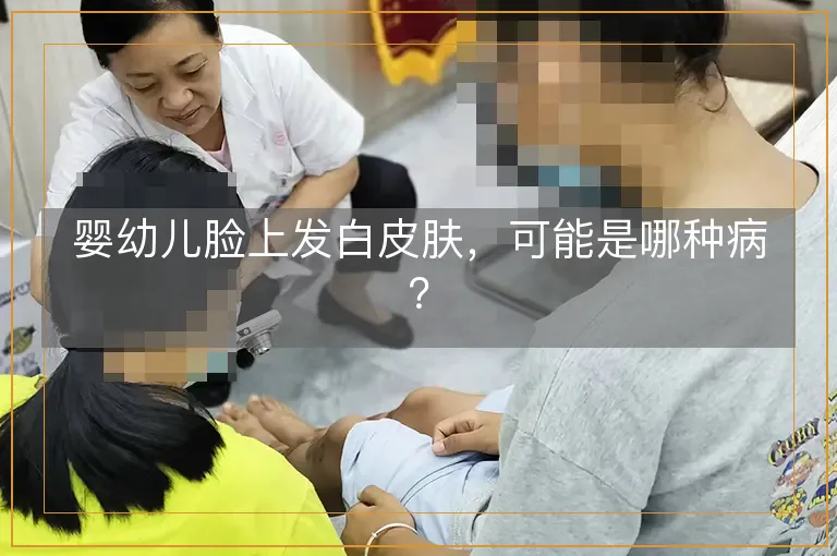 婴幼儿脸上发白皮肤，可能是哪种病？