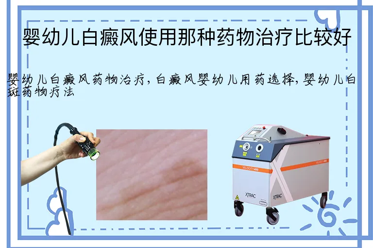 婴幼儿白癜风使用那种药物治疗比较好