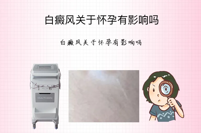 白癜风关于怀孕有影响吗