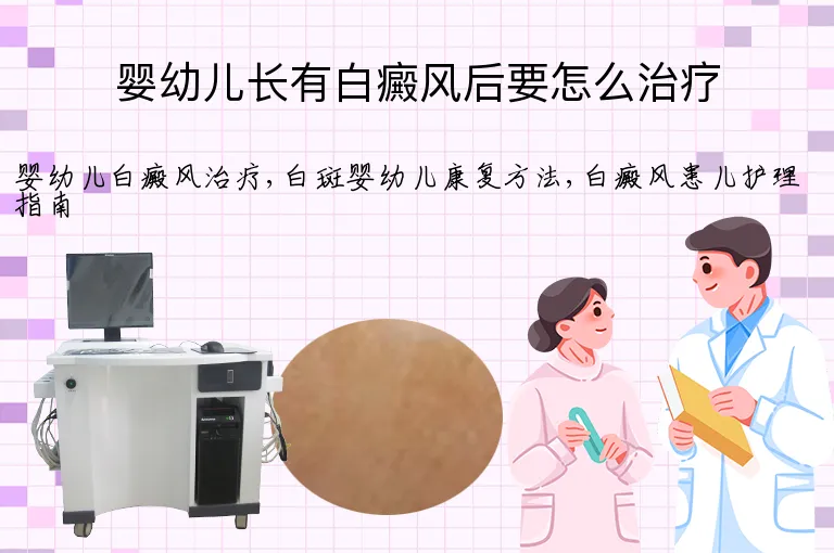 婴幼儿长有白癜风后要怎么治疗