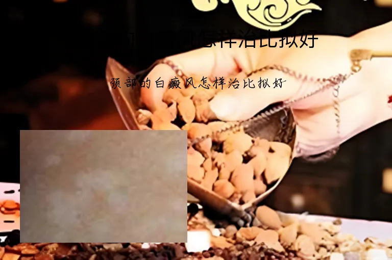 颈部的白癜风怎样治比拟好