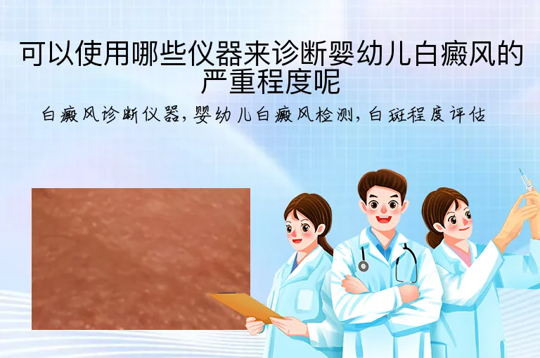 可以使用哪些仪器来诊断婴幼儿白癜风的严重程度呢