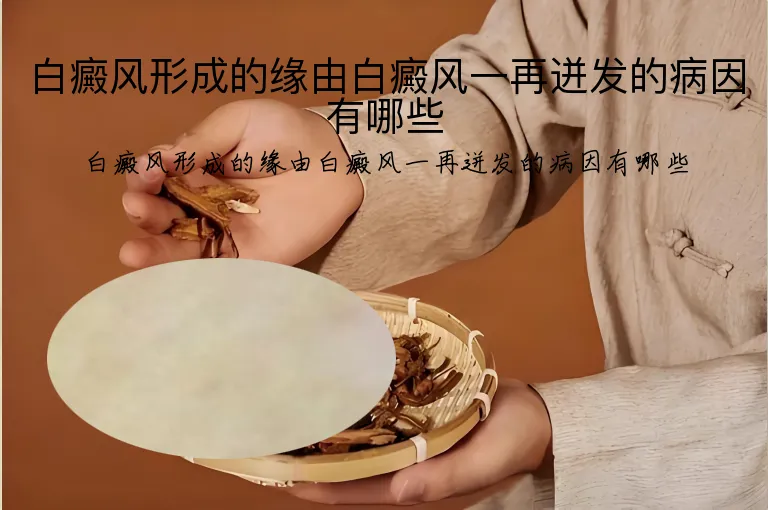 白癜风形成的缘由白癜风一再迸发的病因有哪些